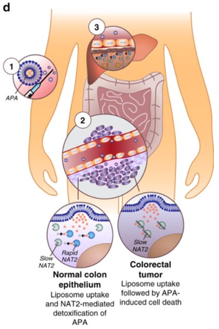 科學家發(fā)現(xiàn)治療結直腸癌的新藥(圖1) 1-200320145415191.png